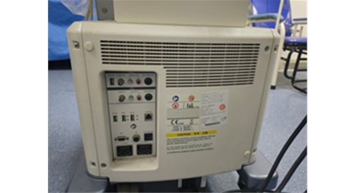 超声检查设备LOGIO P6